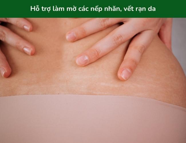 Body oil giúp cải thiện các nếp nhăn và vết rạn trên da (Nguồn: Dmitry Epov - Getty Images)